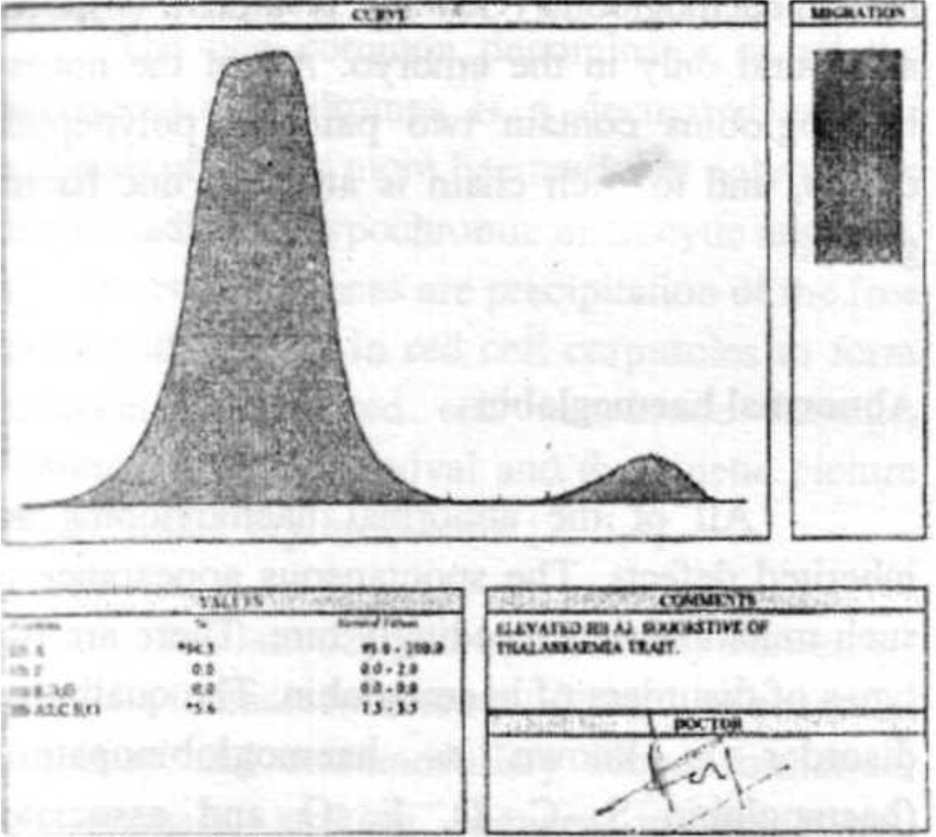 Electrophoresis of Subject No 1