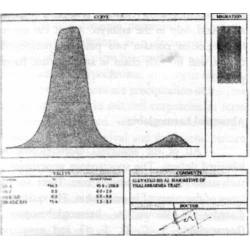 Article figure