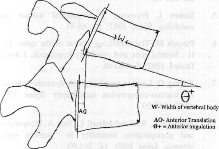 Technique of measurement of anterior translation and positive / anterior rotation on lateral flexion view of the lumbar spine.