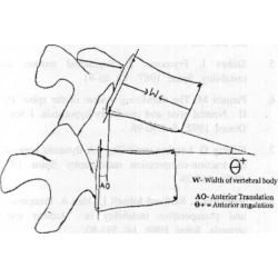 Article figure