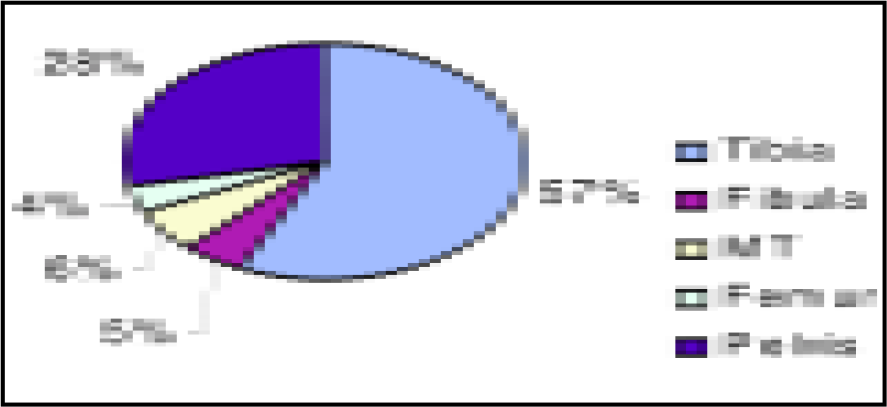 Site distribution of stress fractures in female cadets