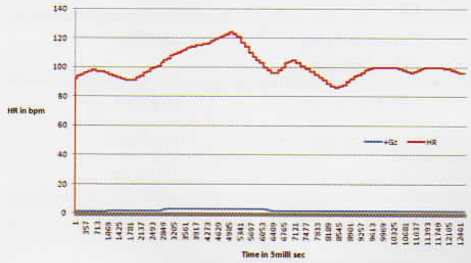 HR response during +3Gz exposure