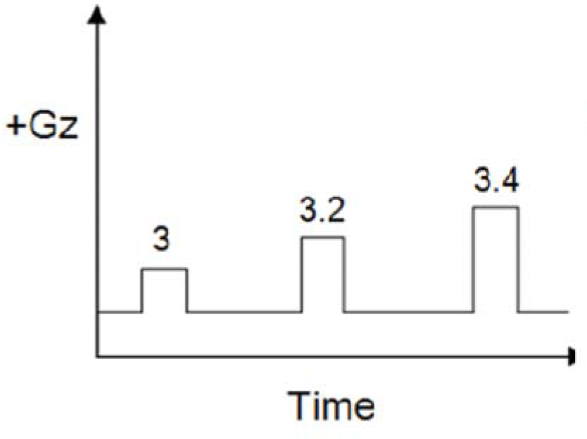 +Gz run profile