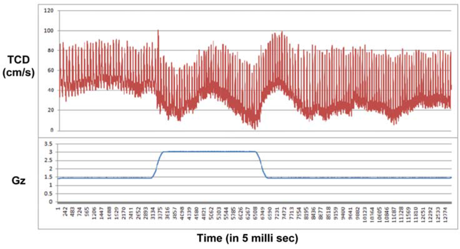 TCD response during +3Gz exposure