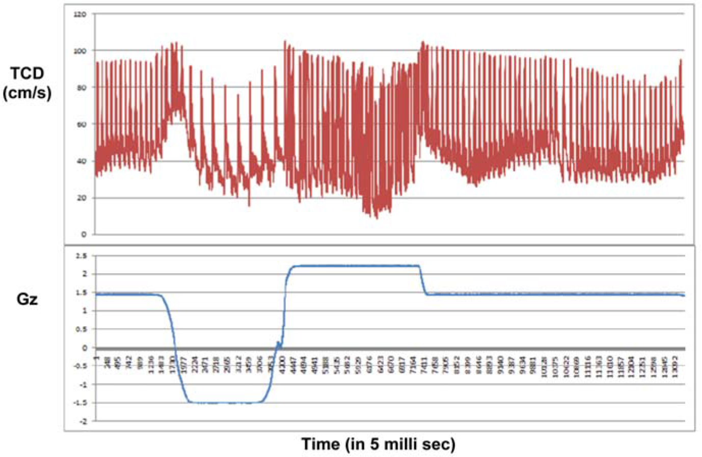 TCD response during Push-pull exposure The reflexogenic bradycardia during –Gz phase and tachycardia during +Gz phase is very evident during Push-pull run