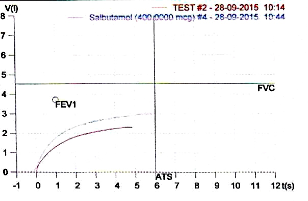 FEV1 Post Salbutamol Inhalation