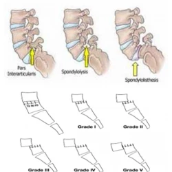 Article figure