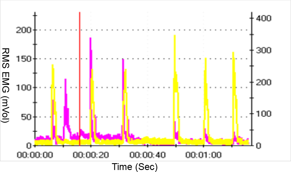 Raw RMS EMG data obtained from two muscles (Pink – rectus abdominis, Yellow- soleus) while performing AGSM on the AGSM training rig.