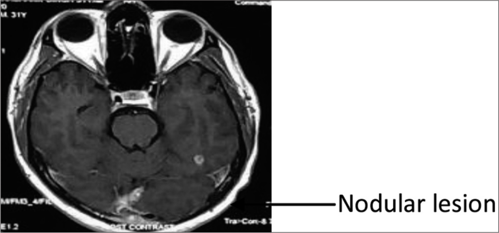 Magnetic resonance imaging brain September 2020.