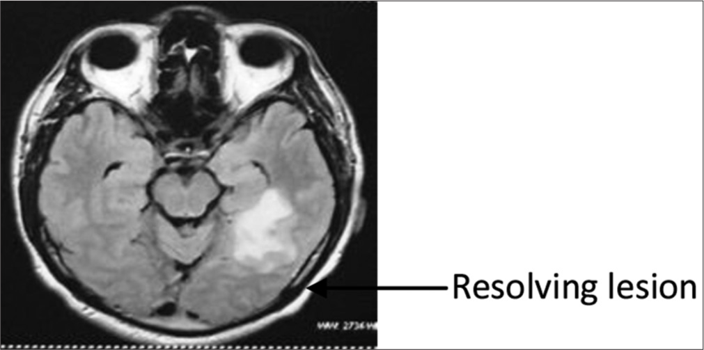 Magnetic resonance imaging brain October 2020.